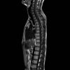 6 imágenes de la columna vertebral imágenes de la columna vertebral t1 total combinadas