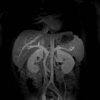 Imágenes de 4 vasculares imágenes abdominales vasculares dinámicas mejoradas de quick3d